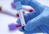 Hantavirus update: 97 contacts monitored across Gauteng and Western Cape A gloved hand holding a positive blood sample test tube in a laboratory setting representing hantavirus diagnostic testing.