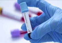Hantavirus update: 97 contacts monitored across Gauteng and Western Cape A gloved hand holding a positive blood sample test tube in a laboratory setting representing hantavirus diagnostic testing.